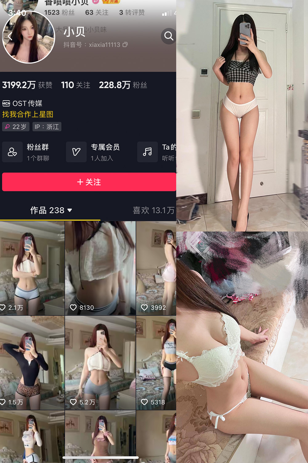 【在线看】抖音 小贝 VIP 微密圈 NO.012期 【25P4V】 - XZWang-写真网-XZWang-写真网
