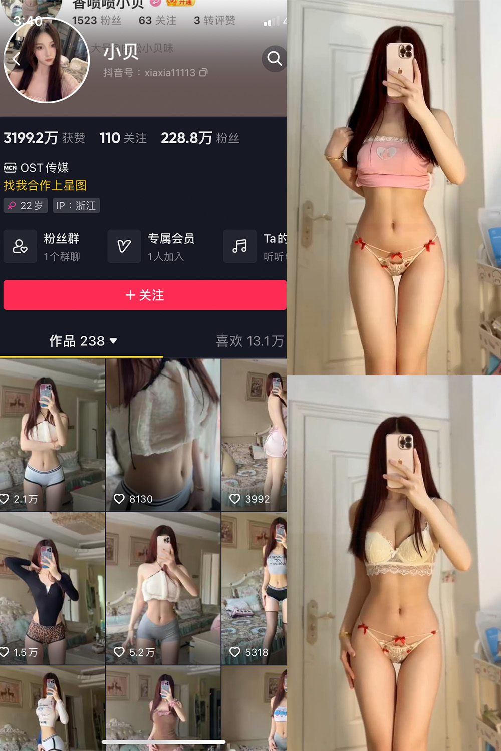 【在线看】抖音 小贝 VIP 微密圈 NO.013期 【19P6V】 - XZWang-写真网-XZWang-写真网