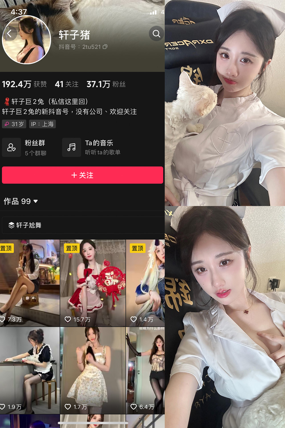 【在线看】抖音 轩子巨二兔 微密圈 NO.023期 【8P1V】 - XZWang-写真网-XZWang-写真网