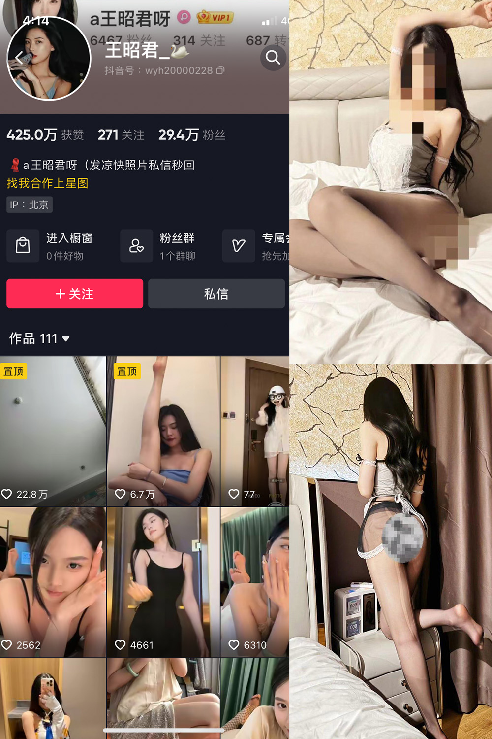 【在线看】抖音 王昭君 微密圈 NO.020期 【8P2V】 - XZWang-写真网-XZWang-写真网