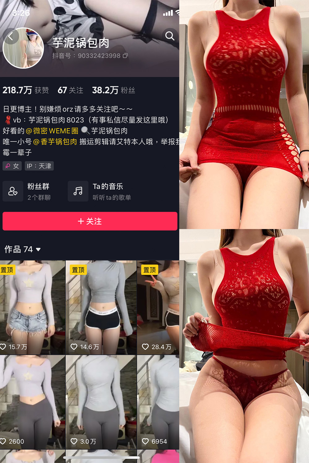 【在线看】抖音 芋泥锅包肉 微密圈 NO.016期 【10P2V】 - XZWang-写真网-XZWang-写真网