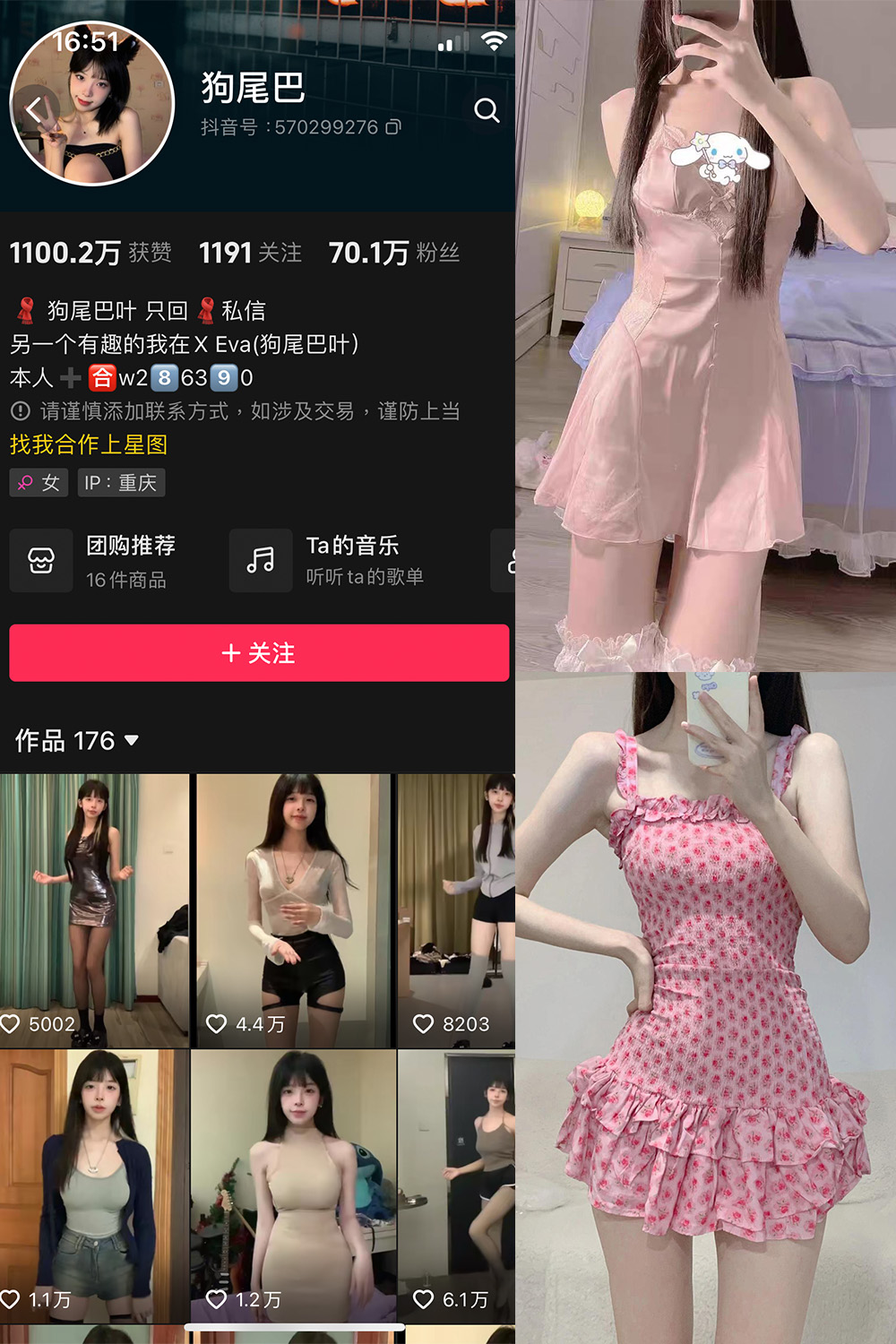 【在线看】抖音 狗尾巴 微密圈 NO.004期 【25P5V】 - XZWang-写真网-XZWang-写真网