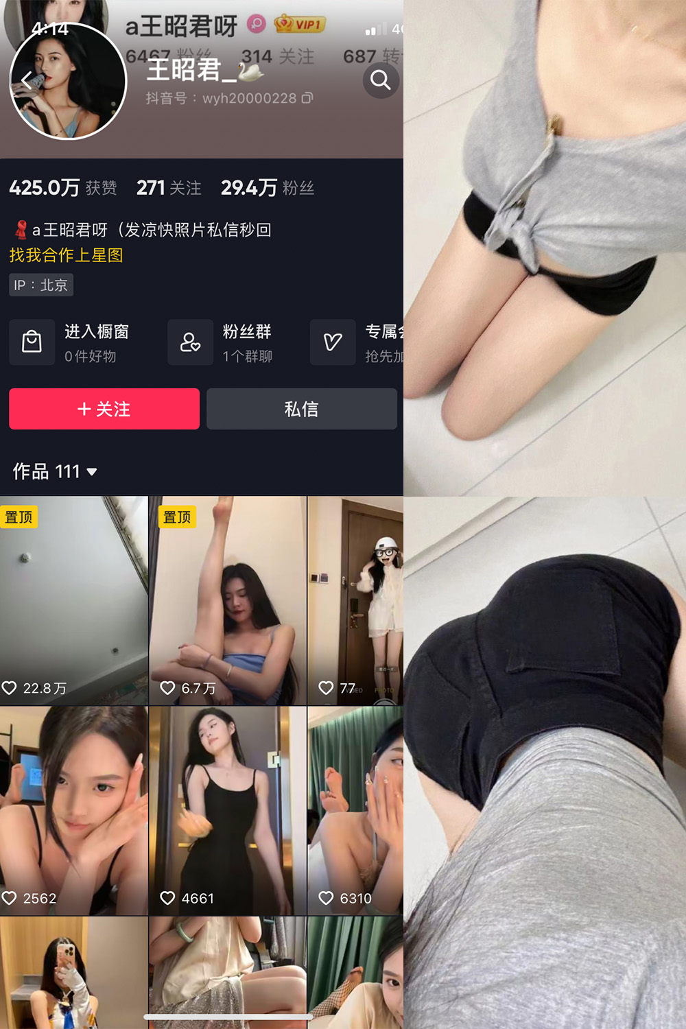 【在线看】抖音 王昭君 微密圈 NO.017期 【23P】 - XZWang-写真网-XZWang-写真网