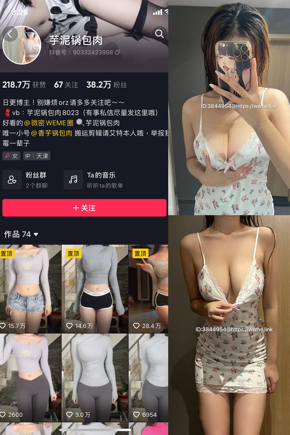 【在线看】抖音 芋泥锅包肉 微密圈 NO.013期 【35P2V】 - XZWang-写真网-XZWang-写真网