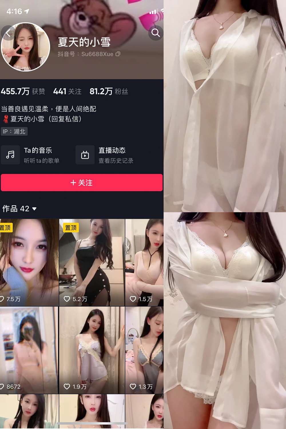 【在线看】抖音 夏天的小雪 微密圈 嘉宾专享 NO.001-011期 - XZWang-写真网-XZWang-写真网
