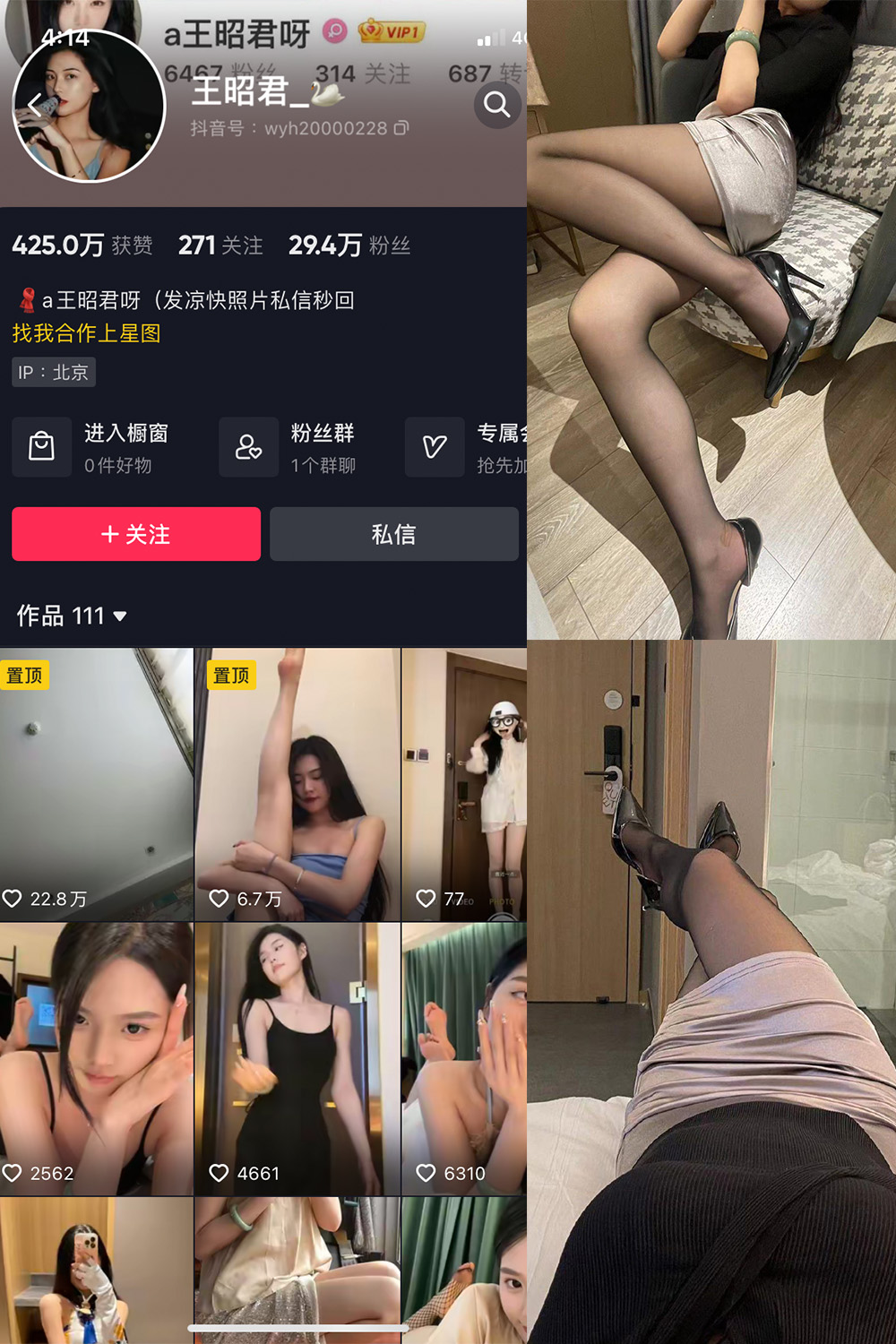 【在线看】抖音 王昭君 微密圈 NO.011期 【6P】 - XZWang-写真网-XZWang-写真网