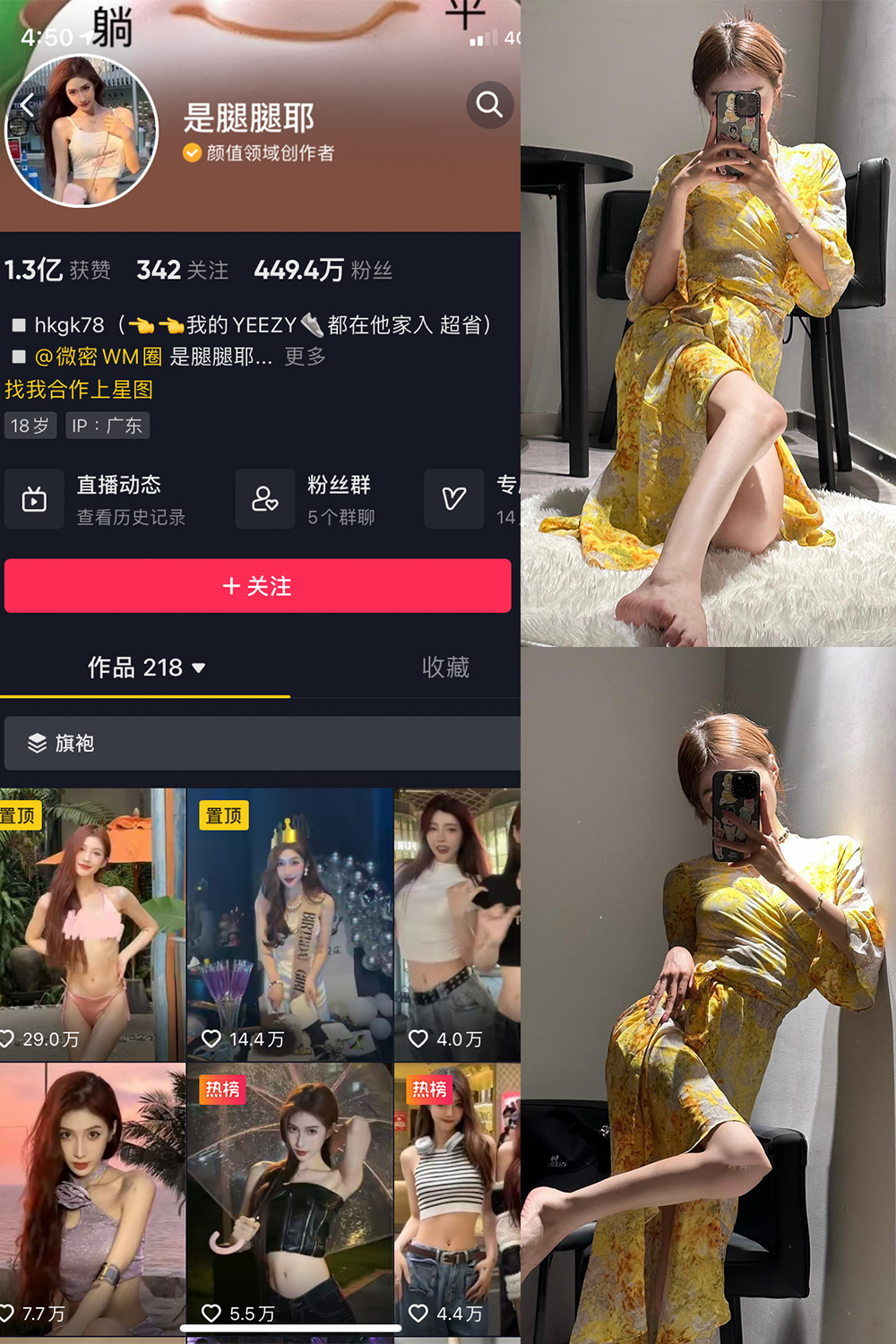 【在线看】抖音 是腿腿耶 微密圈 NO.026期 【6P】 - XZWang-写真网-XZWang-写真网