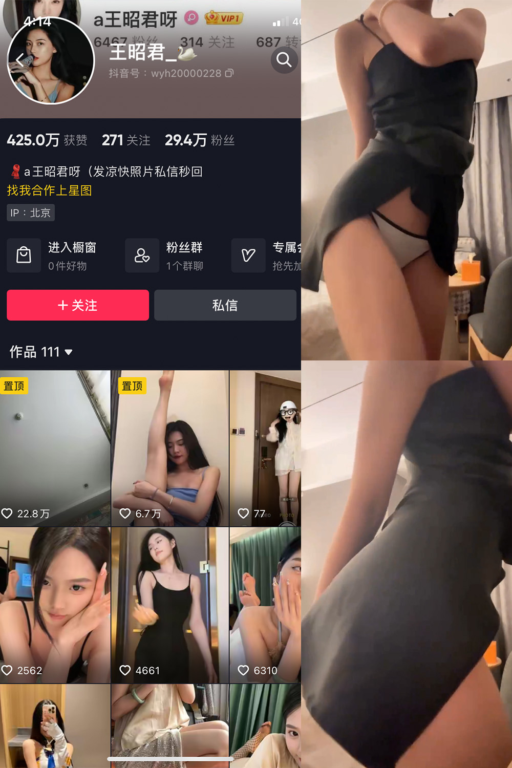 【在线看】抖音 王昭君 微密圈 NO.010期 【11P1V】 - XZWang-写真网-XZWang-写真网
