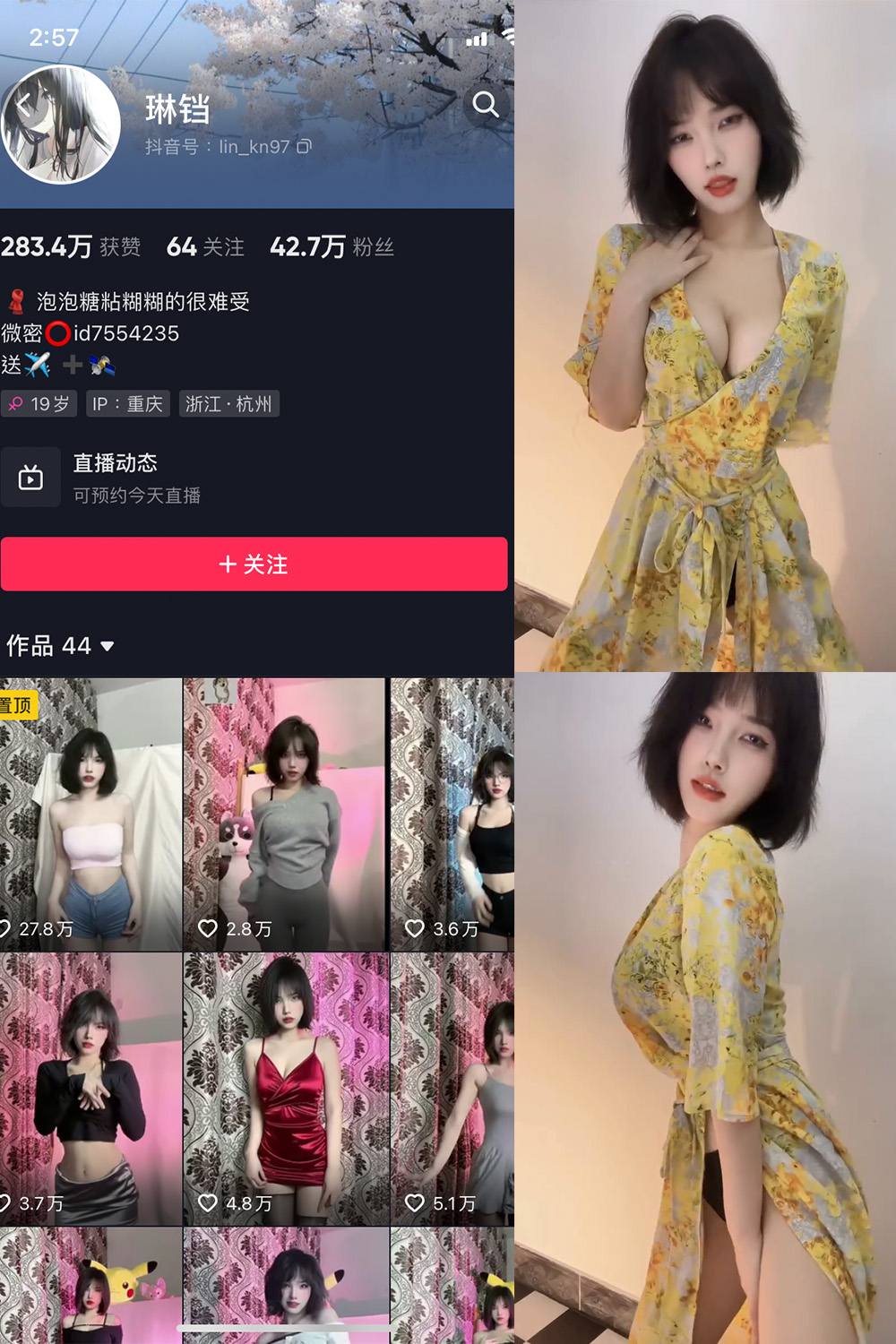 【在线看】抖音 琳铛 微密圈 NO.016期 【10P3V】 - XZWang-写真网-XZWang-写真网