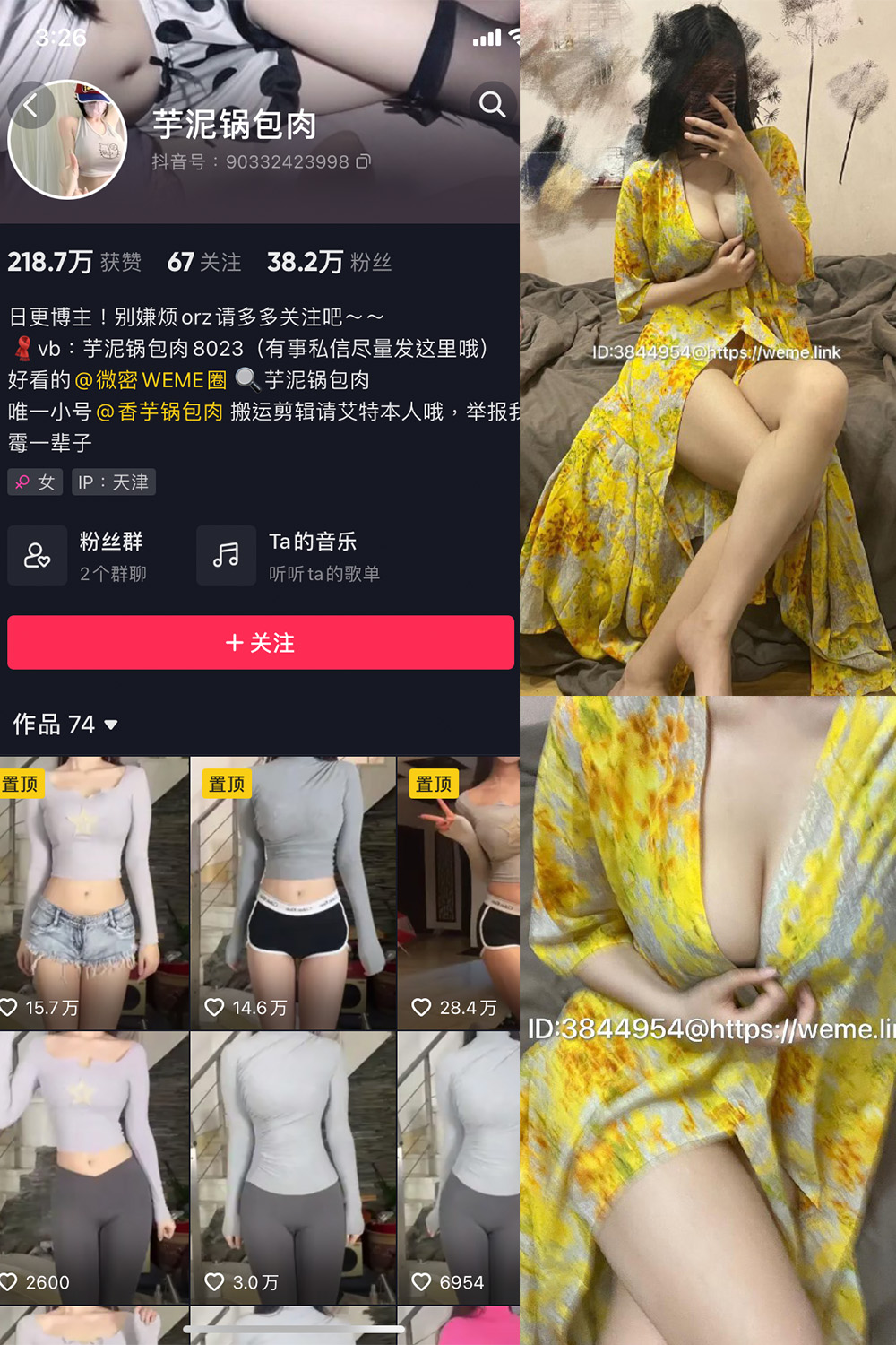 【在线看】抖音 芋泥锅包肉 微密圈 NO.010期 【4P】 - XZWang-写真网-XZWang-写真网