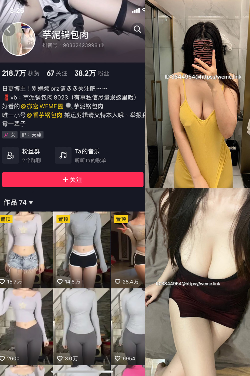 【在线看】抖音 芋泥锅包肉 微密圈 NO.008期 【11P1V】 - XZWang-写真网-XZWang-写真网