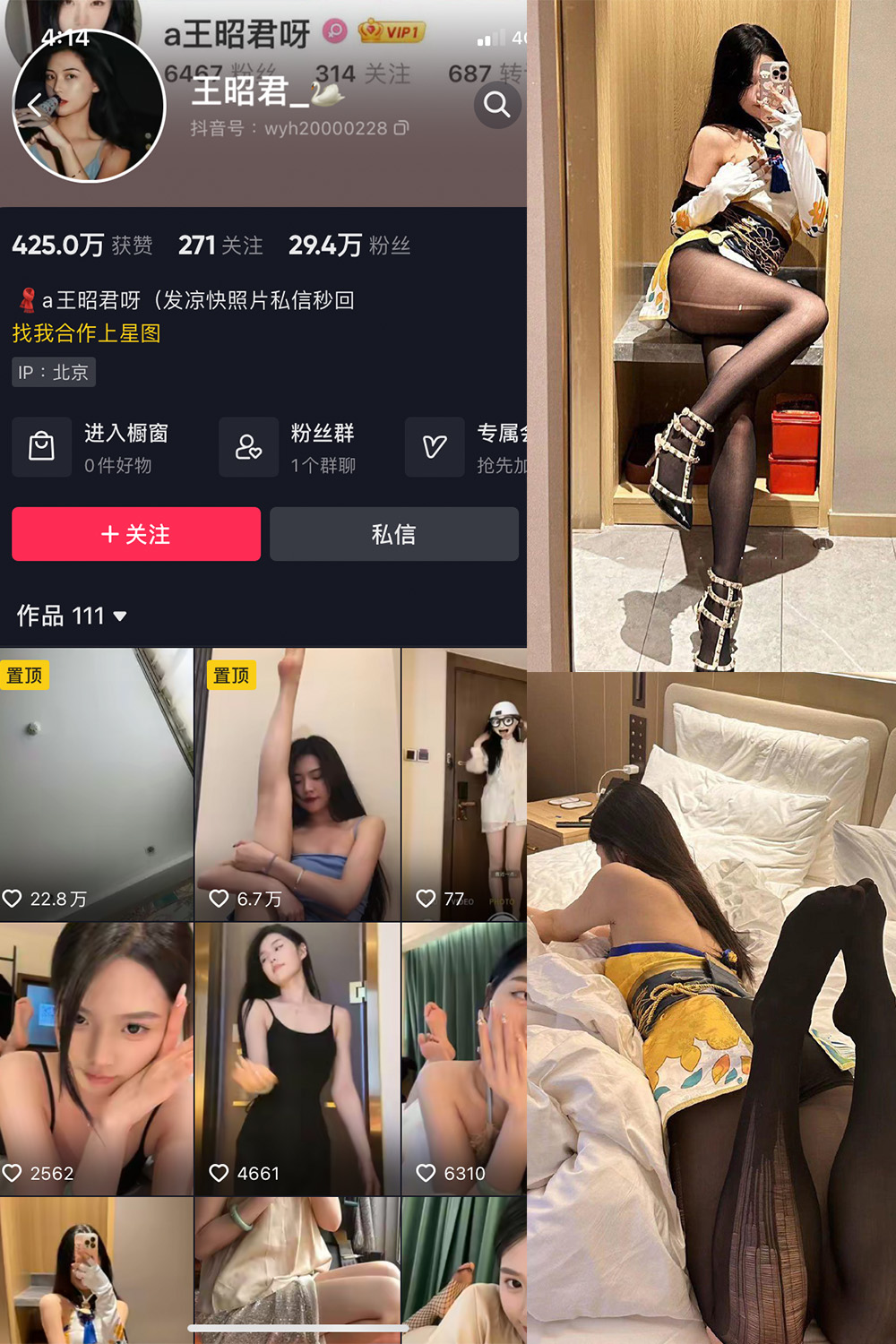 【在线看】抖音 王昭君 微密圈 NO.002期 【14P15V】 - XZWang-写真网-XZWang-写真网