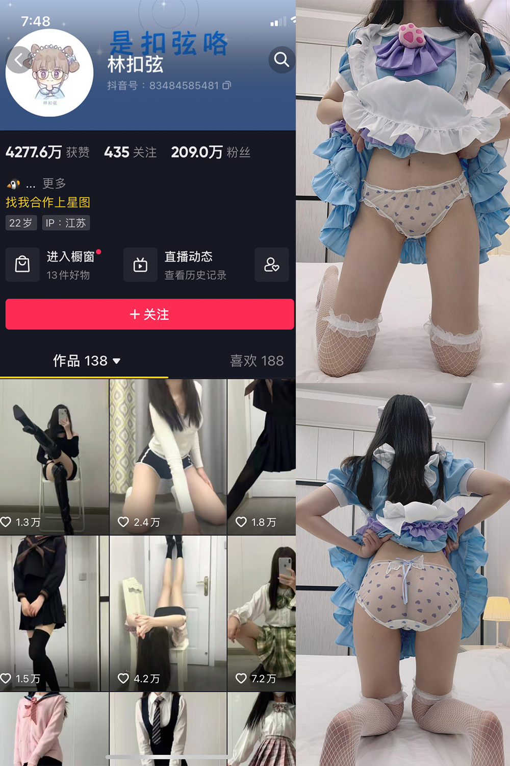 【在线看】抖音 林扣弦 微密圈 NO.026期 【17P】 - XZWang-写真网-XZWang-写真网