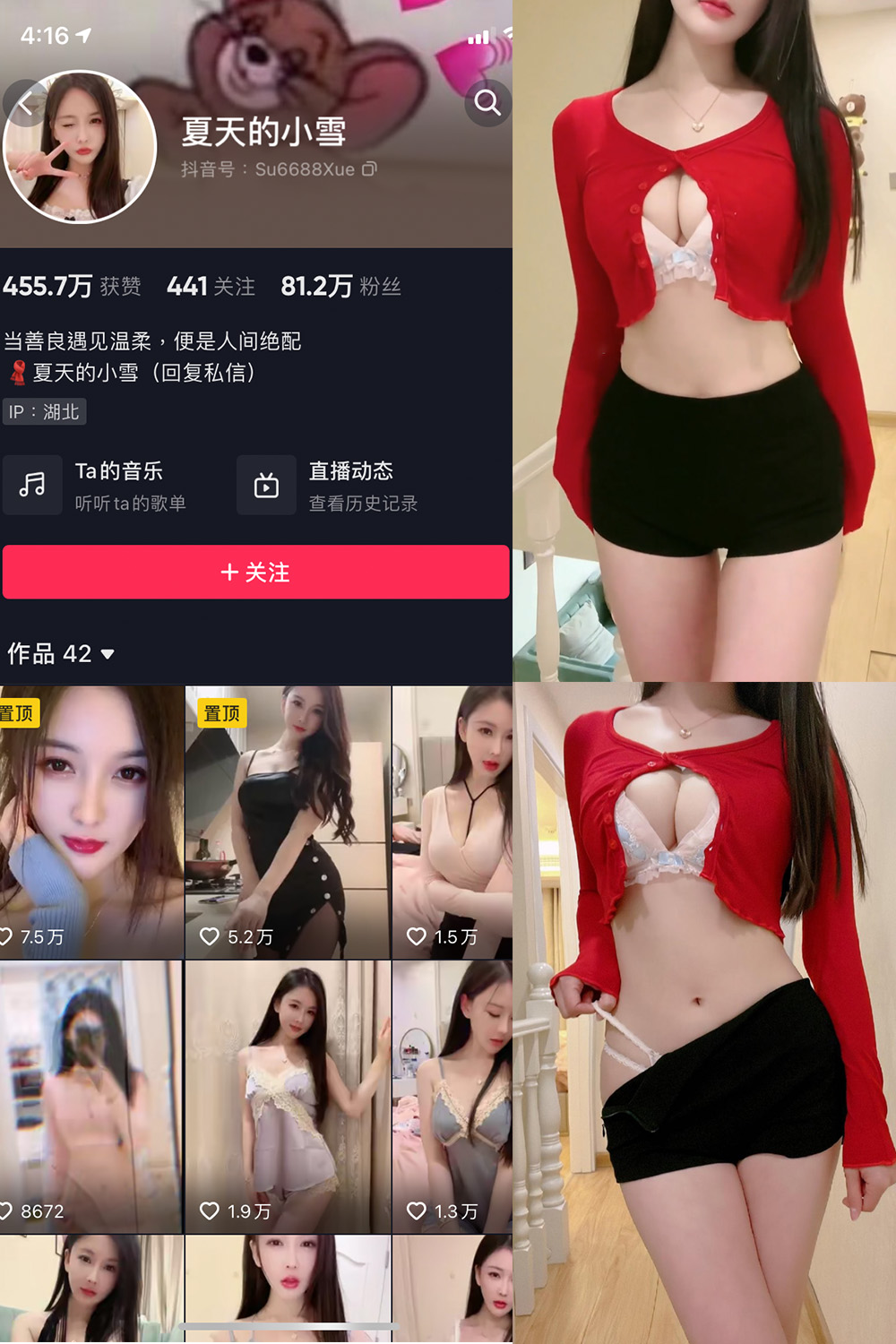 【在线看】抖音 夏天的小雪 微密圈 NO.006期 【3V】 - XZWang-写真网-XZWang-写真网