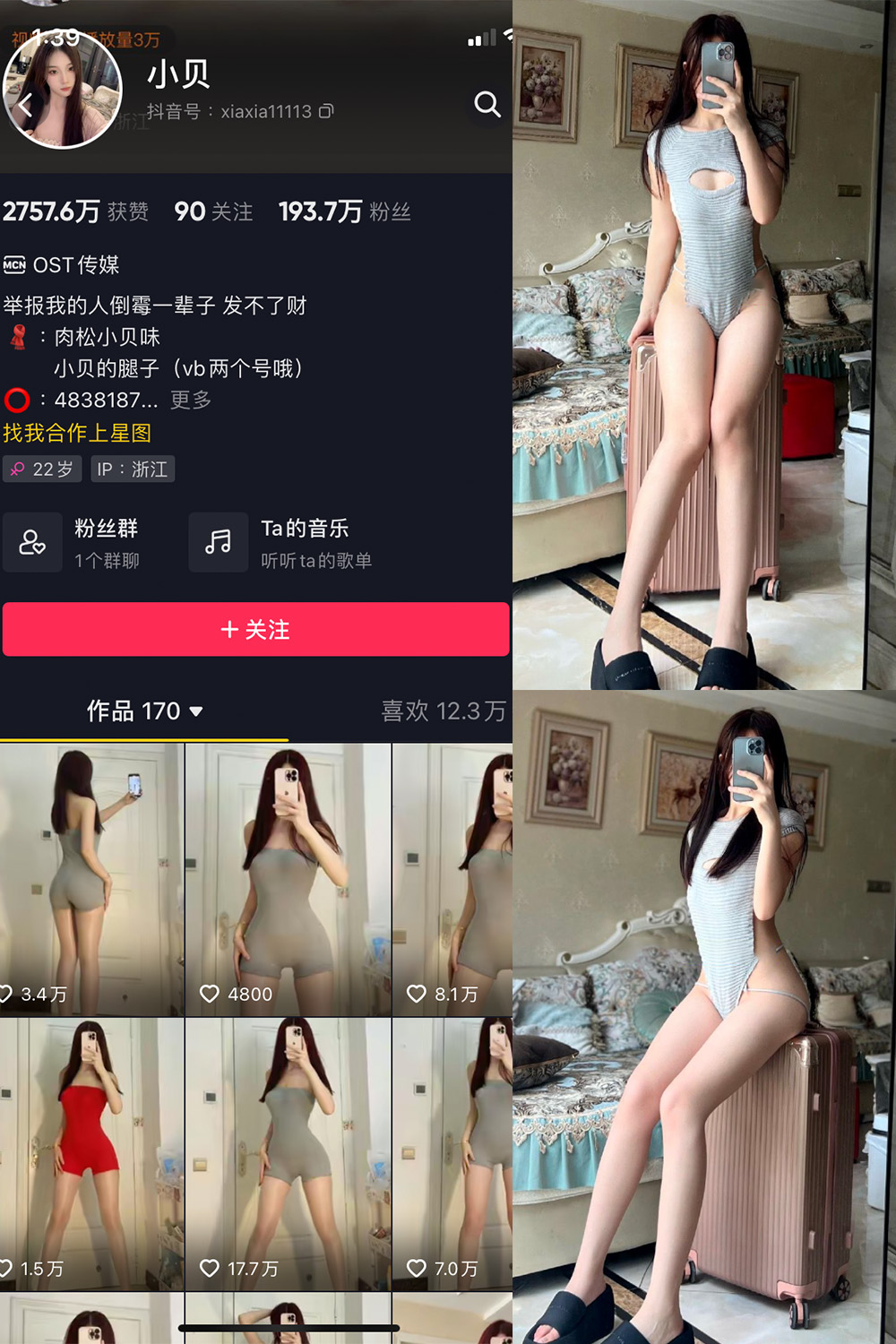 【在线看】抖音 小贝 VIP 微密圈 NO.007期 【28P】 - XZWang-写真网-XZWang-写真网