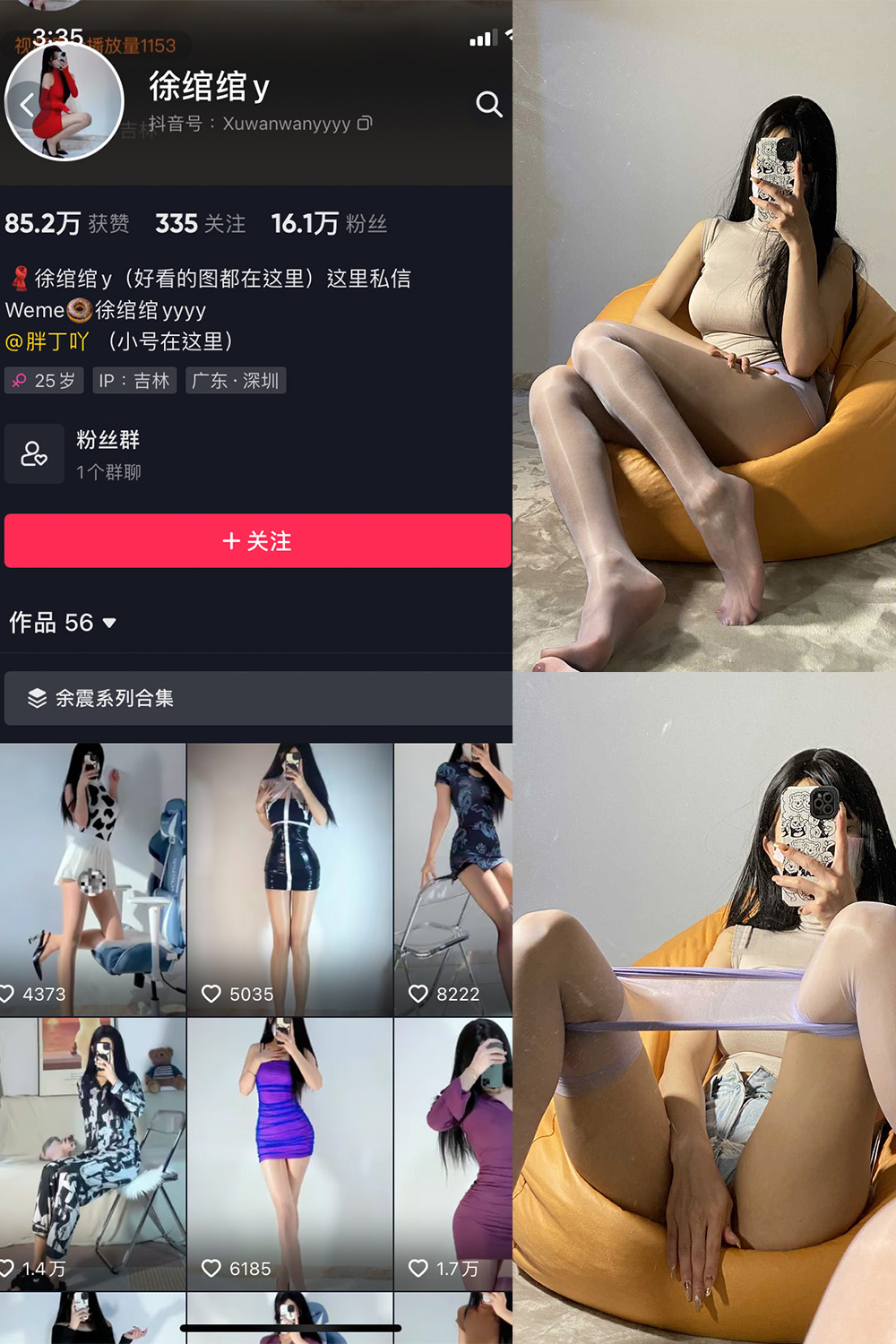 【在线看】抖音 徐绾绾 微密圈 NO.001期 【37P】 - XZWang-写真网-XZWang-写真网