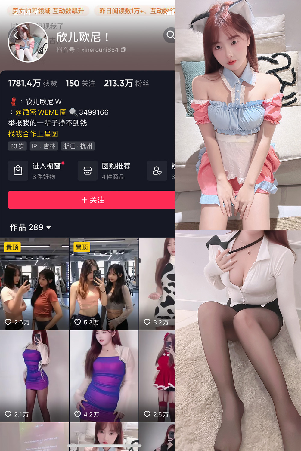 【在线看】抖音 欣儿欧尼 微密圈 NO.001期 【34P】 - XZWang-写真网-XZWang-写真网