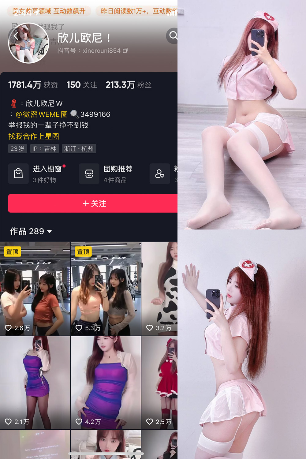 【在线看】抖音 欣儿欧尼 微密圈 NO.002期 【29P】 - XZWang-写真网-XZWang-写真网