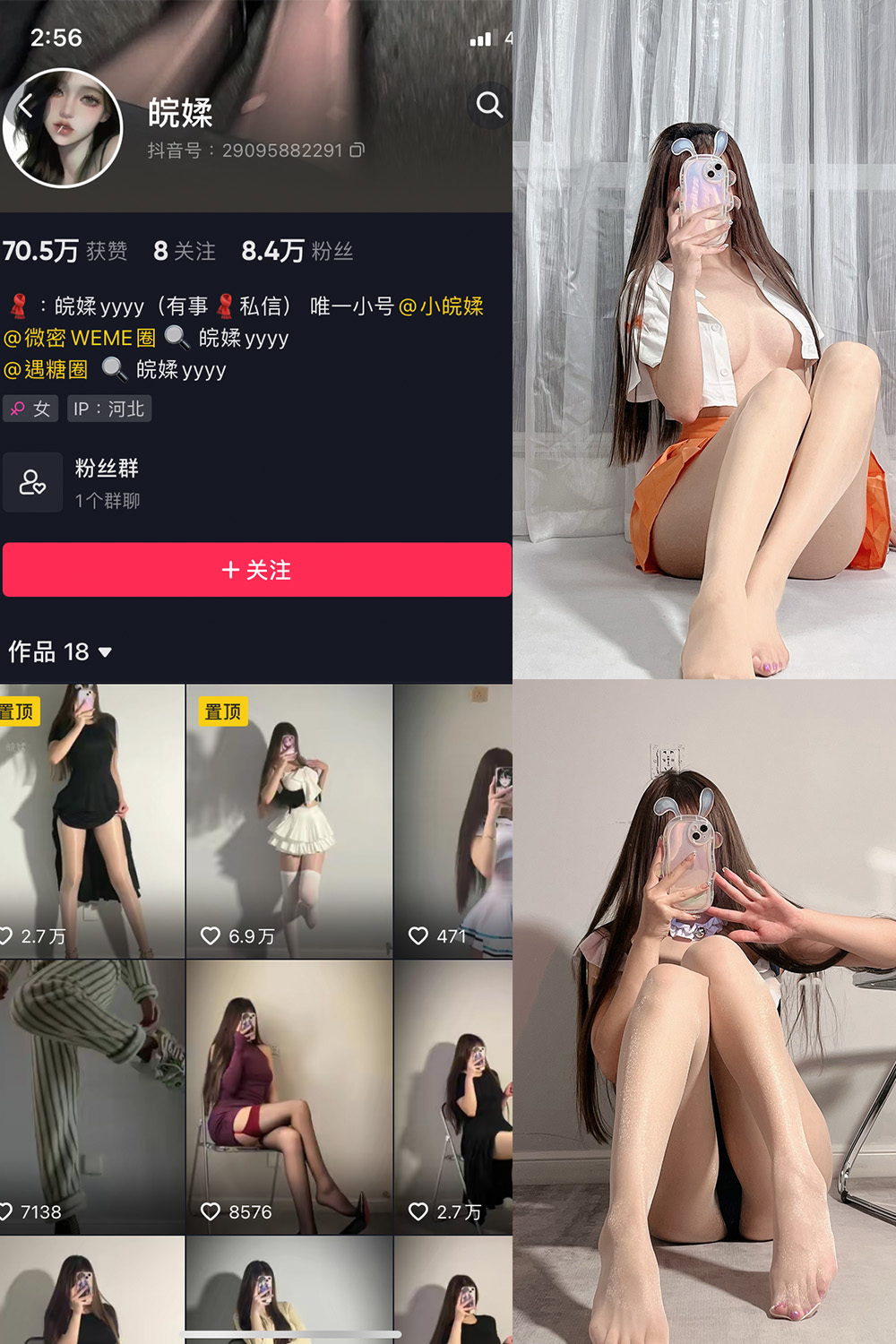 【在线看】抖音 皖媃yyyy VIP 微密圈 NO.002期 【20V】 - XZWang-写真网-XZWang-写真网