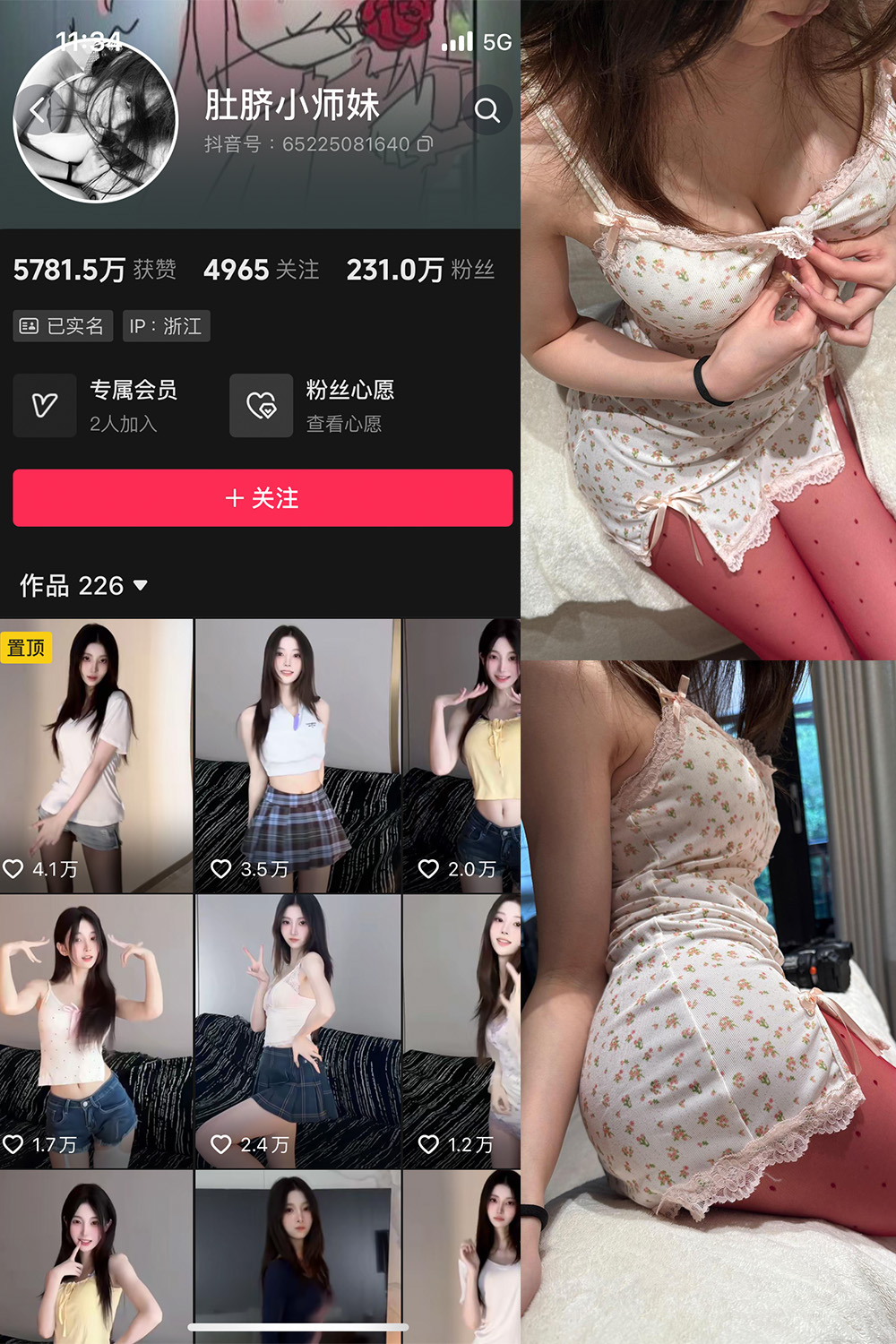 【在线看】抖音 肚脐小师妹 微密圈 NO.037期 【15P2V】 - XZWang-写真网-XZWang-写真网