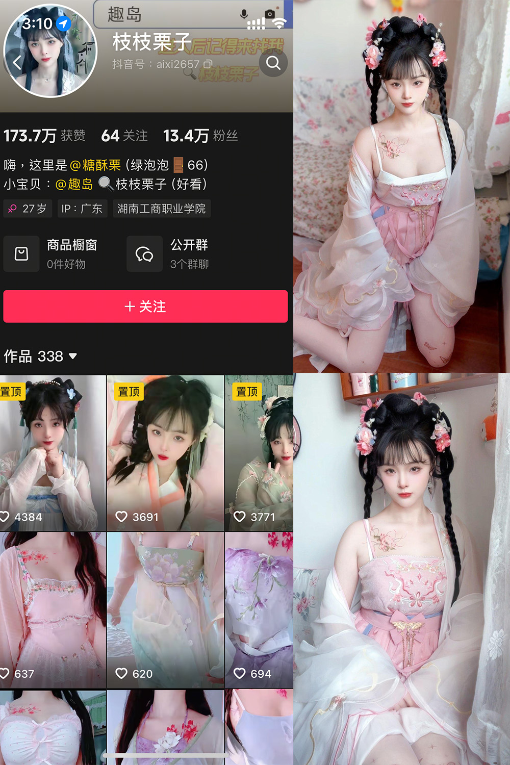 【在线看】抖音 枝枝栗子 微密圈 NO.003期 【28P6V】 - XZWang-写真网-XZWang-写真网