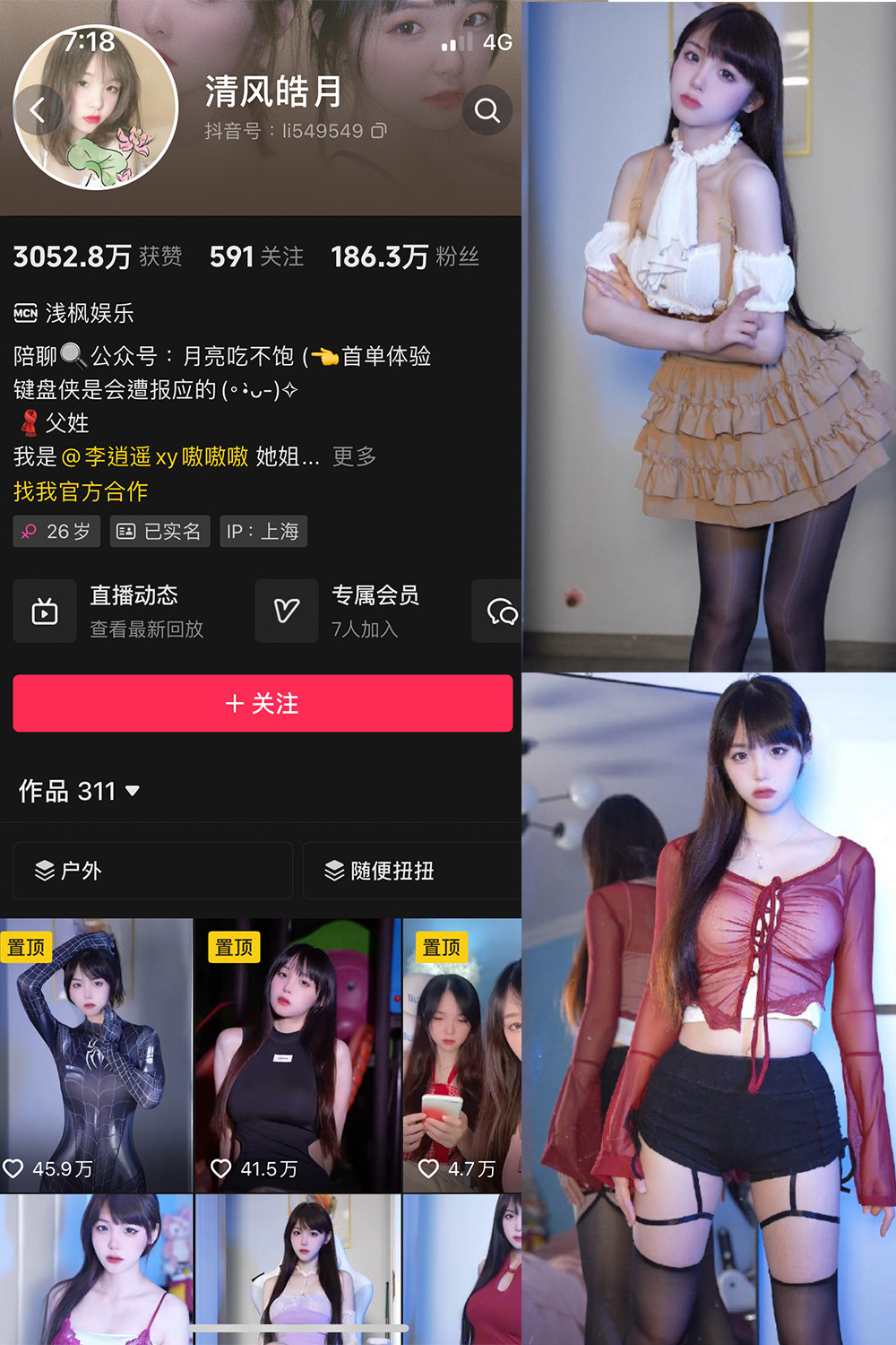 【在线看】抖音 清风皓月 微密圈 NO.001期 【31P14V】 - XZWang-写真网-XZWang-写真网