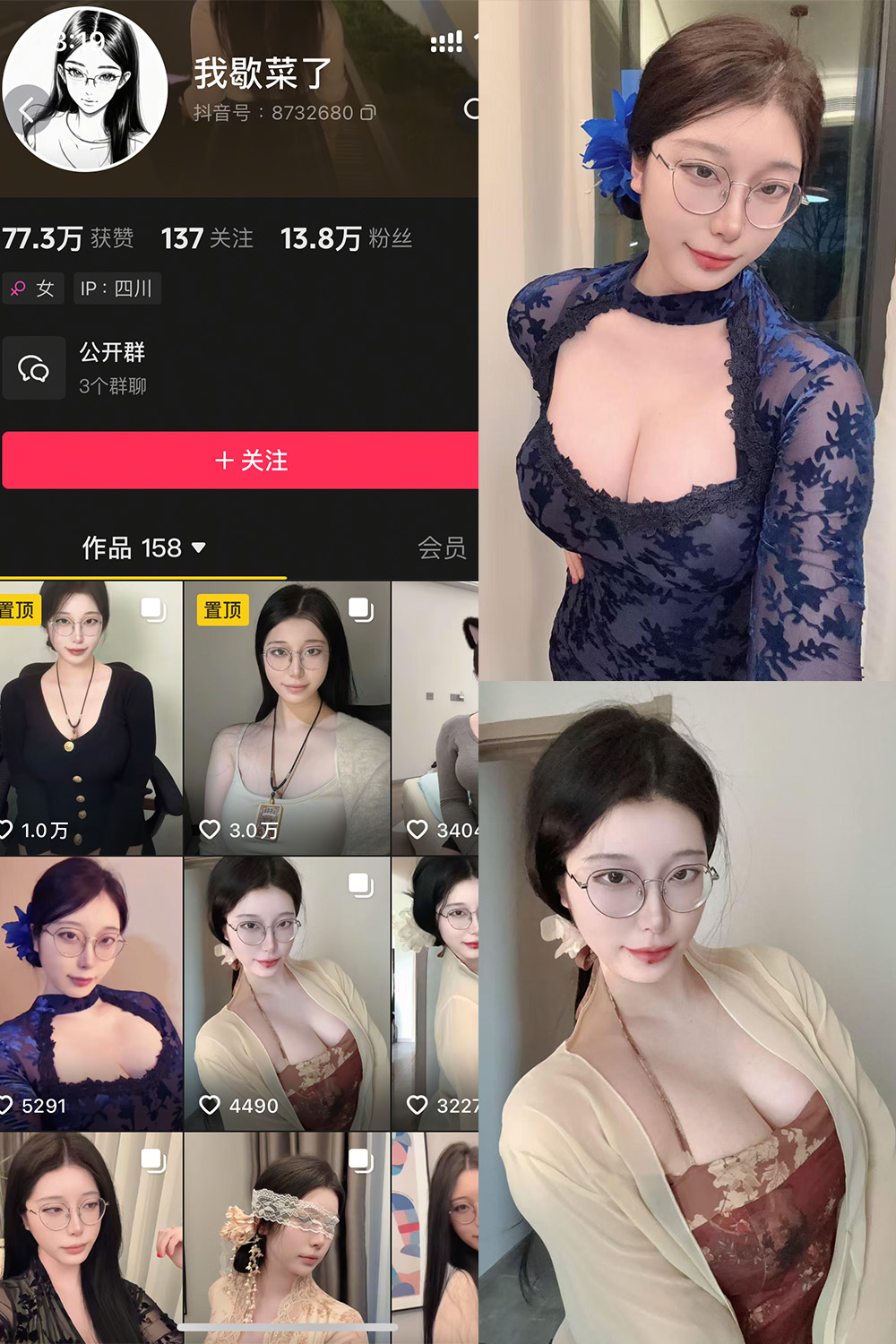 【在线看】抖音 我歇菜了 微密圈 NO.001期 【10P】 - XZWang-写真网-XZWang-写真网