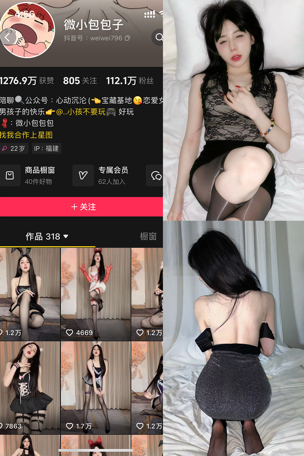 【在线看】抖音 微小包包子 微密圈 NO.006期 【40P5V】 - XZWang-写真网-XZWang-写真网