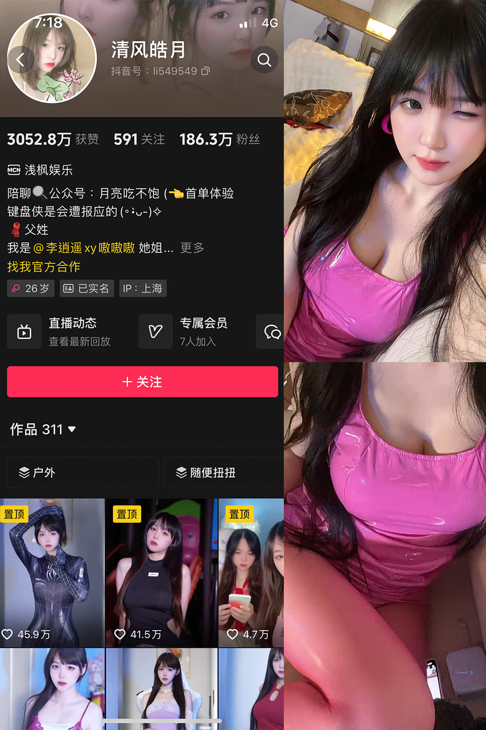 【在线看】抖音 清风皓月 微密圈  NO.003期 【18P6V】 - XZWang-写真网-XZWang-写真网