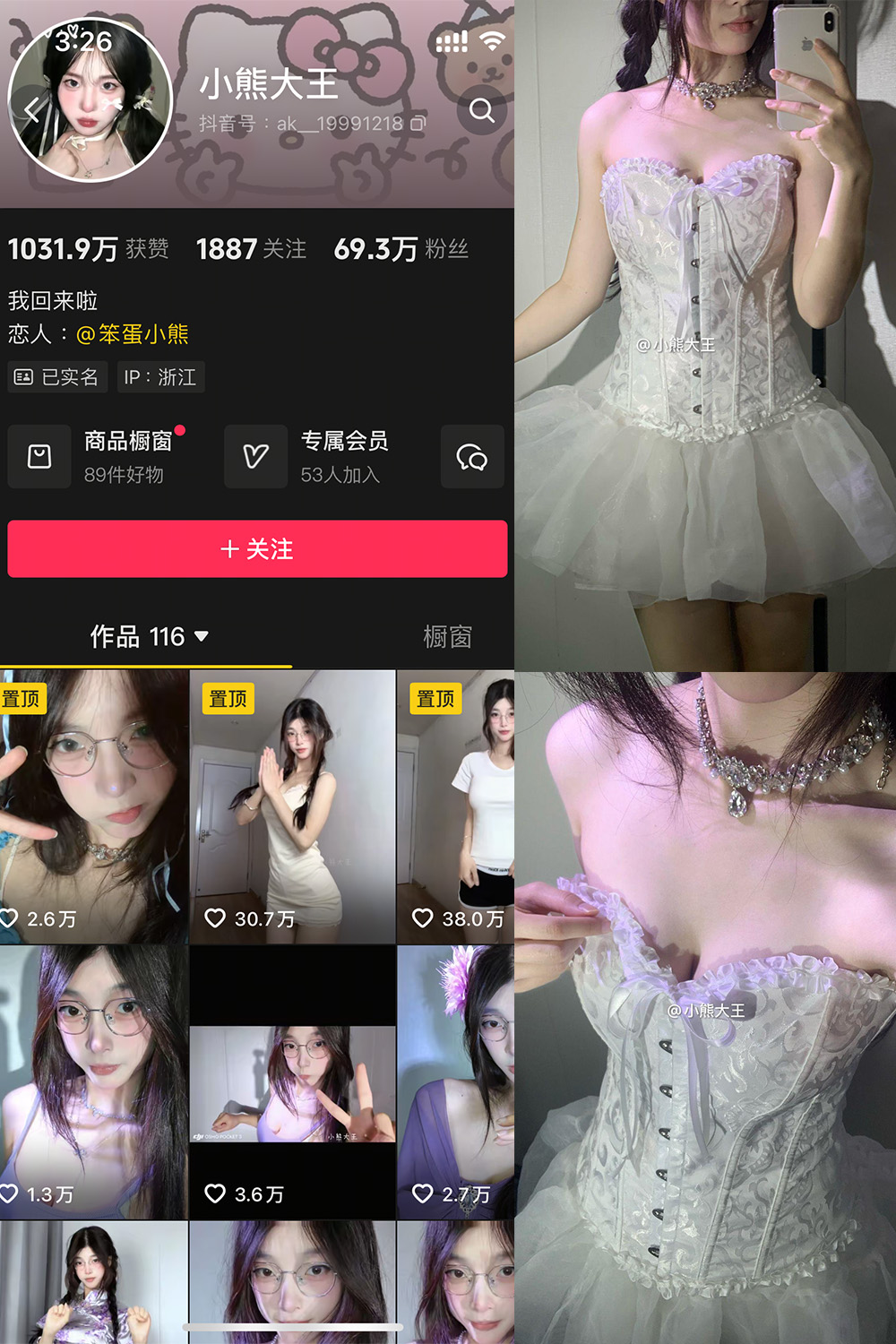 【在线看】抖音 小熊大王 微密圈 001期 【32P】 - XZWang-写真网-XZWang-写真网
