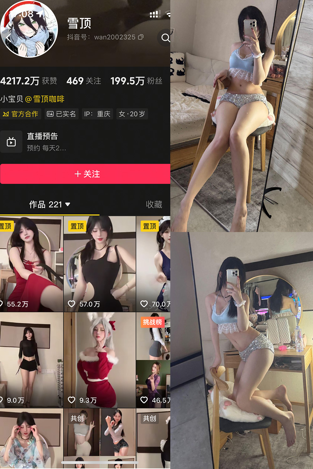 【在线看】抖音 雪顶 岛遇 NO.017期 【25P1V】-XZWang-写真网